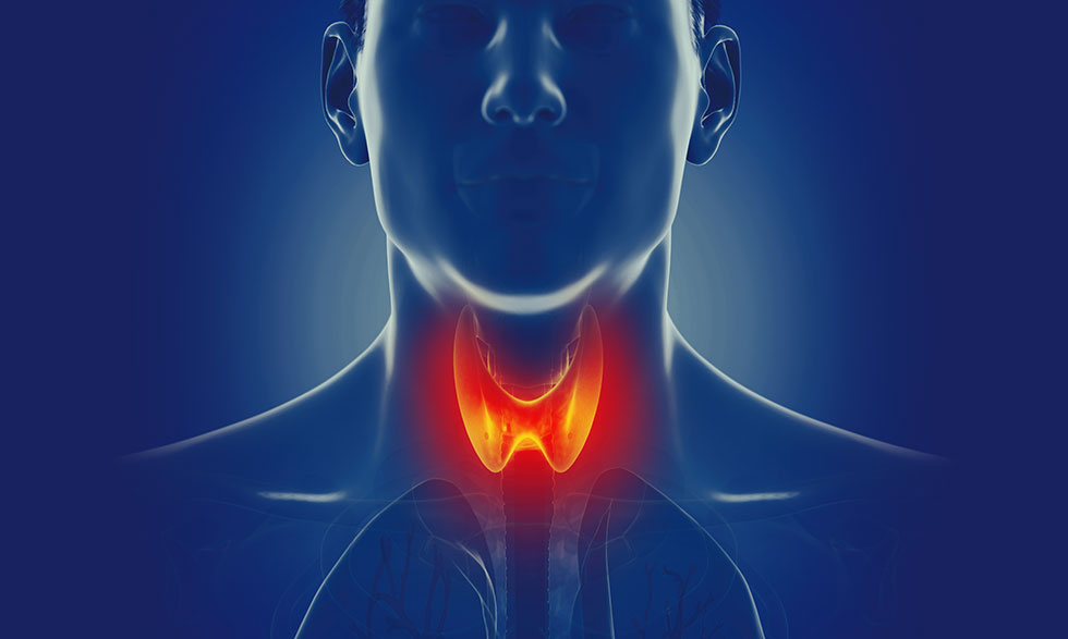 Accelerated Metabolism: Causes & Symptoms of an Overactive Thyroid